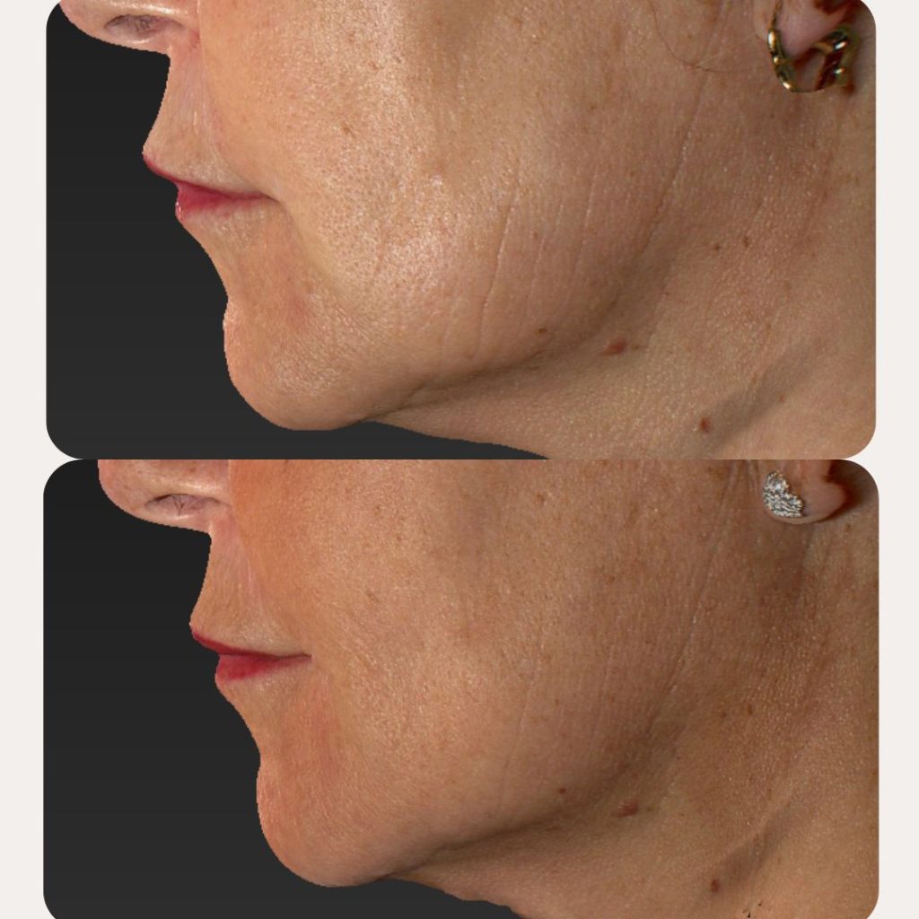 Blend Clínica Carmen Moren